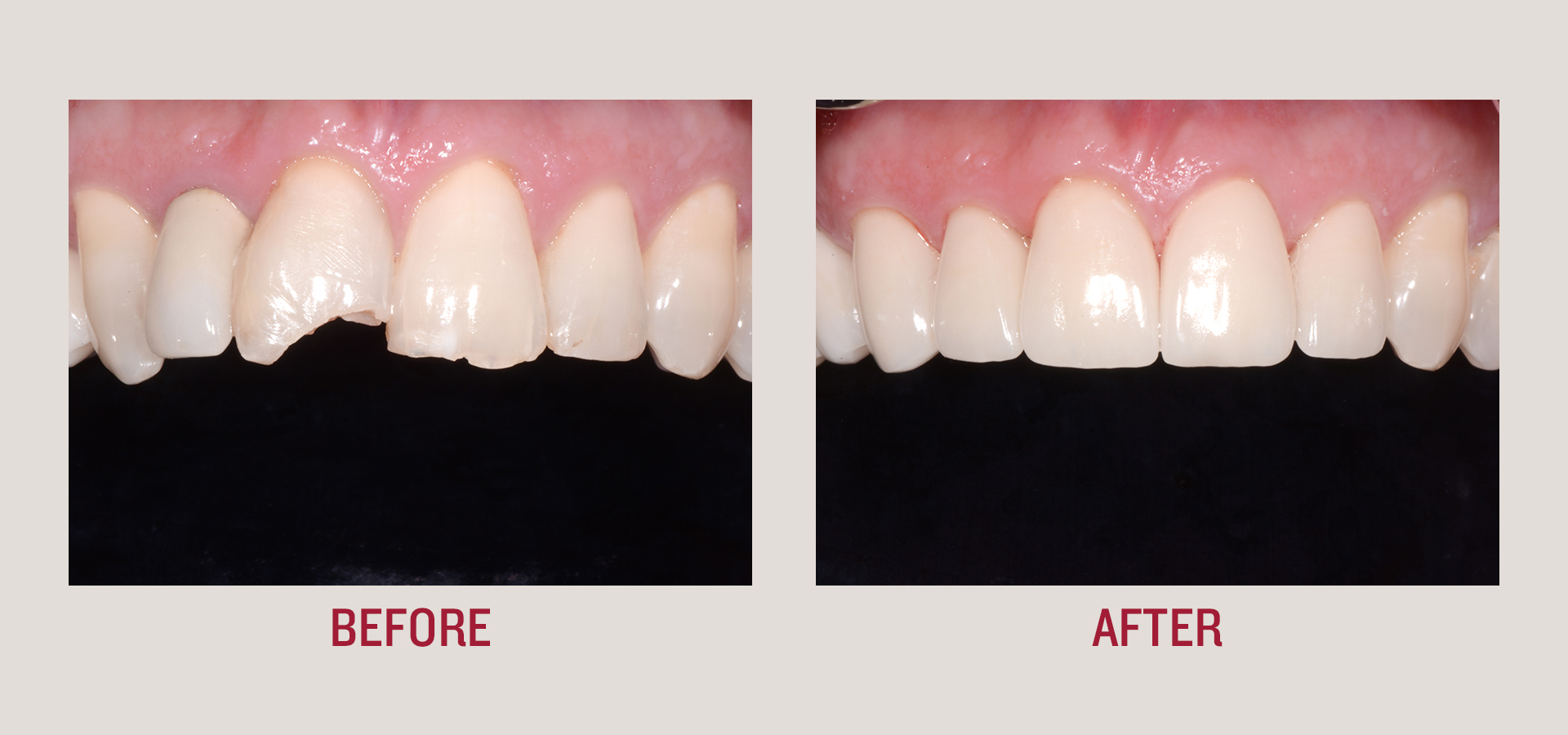 Dentist, Teeth, smile, patient, smile makeover, botox