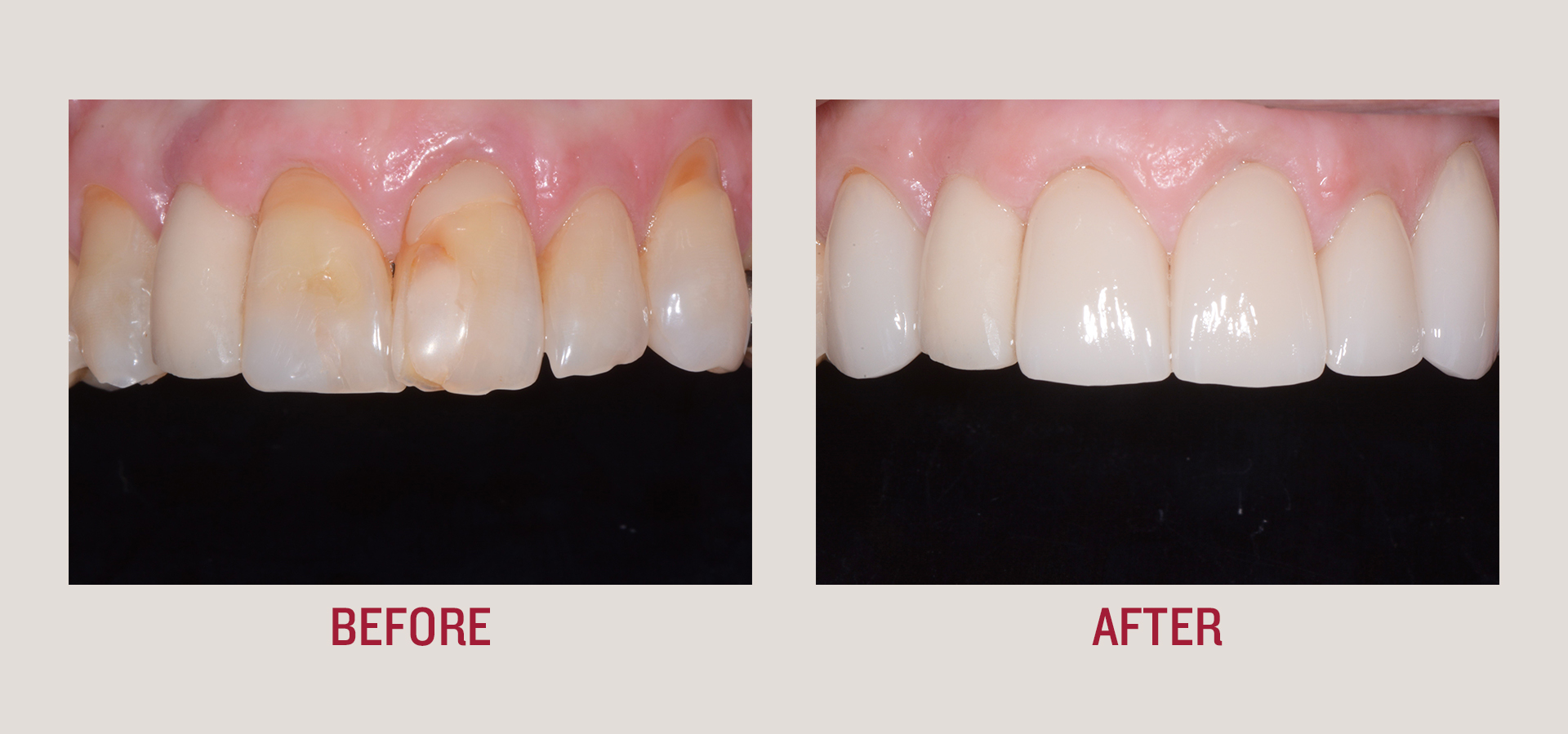 Dentist, Teeth, smile, patient, smile makeover, botox