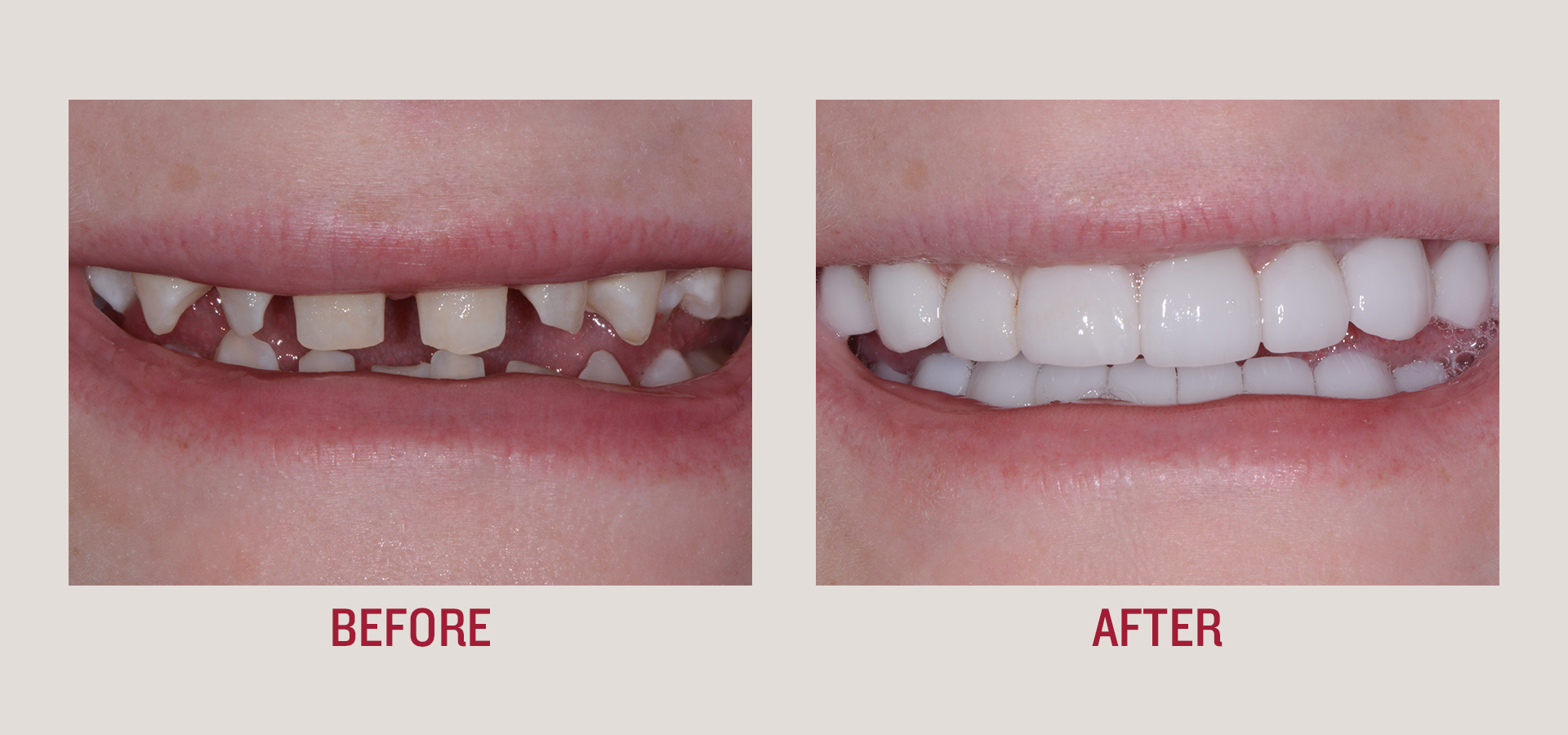 Dentist, Teeth, smile, patient, smile makeover, botox