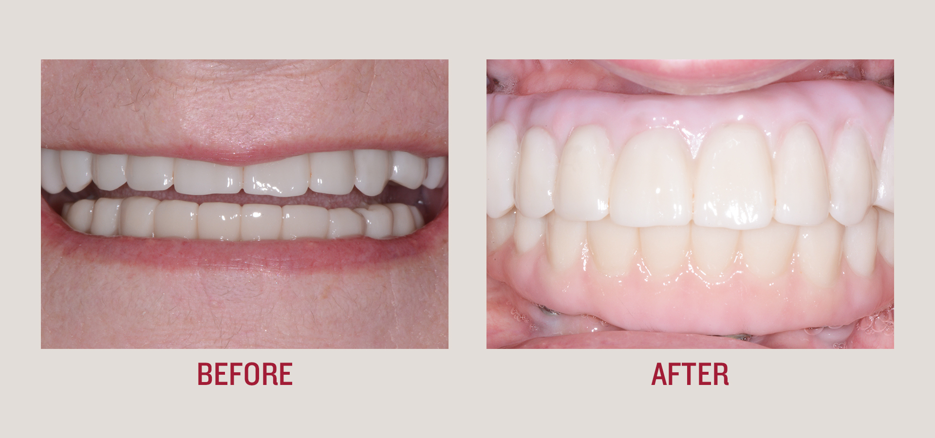 Dentist, Teeth, smile, patient, smile makeover, botox